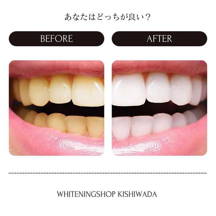 画像515