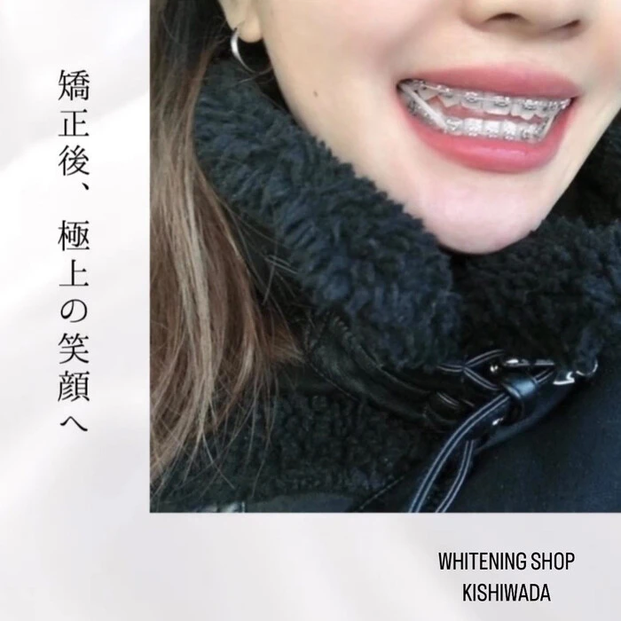 画像561